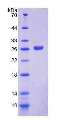 NADP依賴性蘋果酶2(ME2)重組蛋白,Recombinant Malic Enzyme 2, NADP+ Dependent, Mitochondrial (ME2)