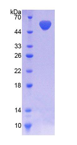 NAD激酶(NADK)重組蛋白,Recombinant NAD Kinase (NADK)