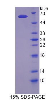 NANOG同源框蛋白(NANOG)重组蛋白,Recombinant NANOG Homeobox Protein (NANOG)