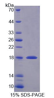 Necdin蛋白(NDN)重组蛋白,Recombinant Necdin (NDN)