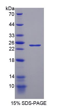 Nei内切核酸酶Ⅷ样蛋白3(NEIL3)重组蛋白,Recombinant Nei Endonuclease VIII Like Protein 3 (NEIL3)