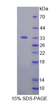 NEL样蛋白2(NELL2)重组蛋白,Recombinant NEL Like Protein 2 (NELL2)