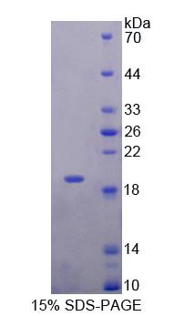 Neudesin神经营养因子(NENF)重组蛋白,Recombinant Neudesin Neurotrophic Factor (NENF)