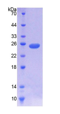 NODAL调节因子1(NOMO1)重组蛋白,Recombinant NODAL Modulator 1 (NOMO1)