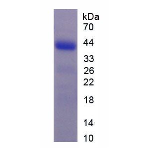 G蛋白偶聯(lián)受體35(GPR35)重組蛋白