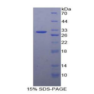 G蛋白偶联受体激酶5(GRK5)重组蛋白,Recombinant G Protein Coupled Receptor Kinase 5 (GRK5)