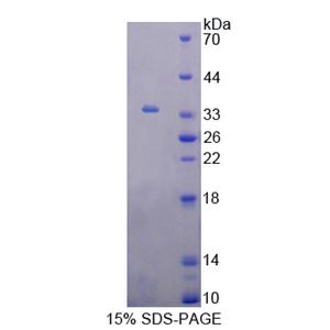 G蛋白偶联受体激酶6(GRK6)重组蛋白,Recombinant G Protein Coupled Receptor Kinase 6 (GRK6)