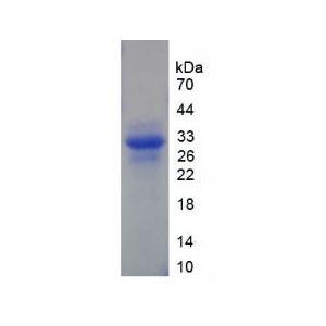 G组着色性干皮病偶联因子(XPG)重组蛋白