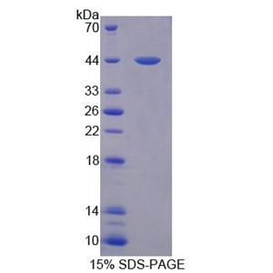 Kruppel样因子15(KLF15)重组蛋白,Recombinant Kruppel Like Factor 15 (KLF15)