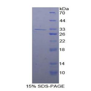 KSP钙黏蛋白(CDH16)重组蛋白,Recombinant Cadherin 16 (CDH16)