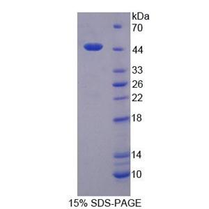 Lemur酪氨酸激酶3(LMTK3)重组蛋白