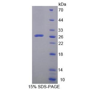 Leupaxin蛋白(LPXN)重组蛋白,Recombinant Leupaxin (LPXN)