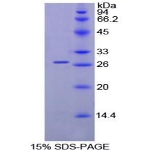 Malectin蛋白(MLEC)重组蛋白,Recombinant Malectin (MLEC)