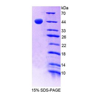 MAX基因關(guān)聯(lián)蛋白A(MgA)重組蛋白,Recombinant MAX Gene Associated Protein (MgA)