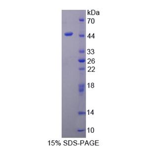 Mg2+/Mn2+依赖性蛋白磷酸酶1A(PPM1A)重组蛋白