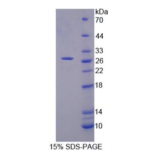 Midline 1蛋白(MID1)重组蛋白
