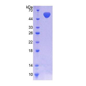 NAD激酶(NADK)重組蛋白,Recombinant NAD Kinase (NADK)