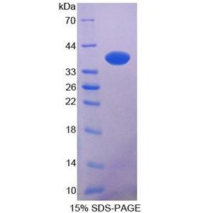 N-myc下游调节基因2(NDRG2)重组蛋白,Recombinant N-myc Downstream Regulated Gene 2 (NDRG2)