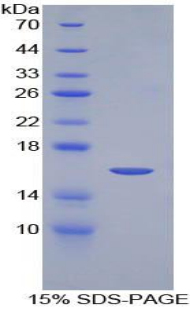 Notch調(diào)控錨蛋白重復(fù)蛋白(NRARP)重組蛋白,Recombinant Notch Regulated Ankyrin Repeat Protein (NRARP)