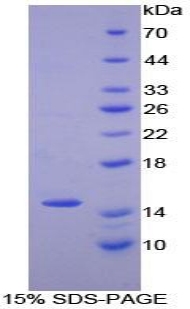 Numb同源物(NUMB)重组蛋白,Recombinant Numb Homolog (NUMB)