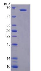 N-甲基-D-天氡氨酸离子能谷氨酸受体2A(GRIN2A)重组蛋白,Recombinant Glutamate Receptor, Ionotropic, N-Methyl-D-Aspartate 2A (GRIN2A)