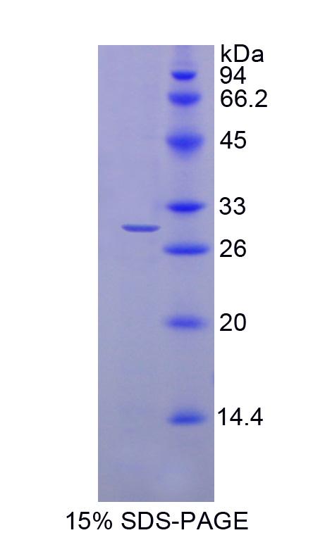 N-酰基乙醇氨酸酰化酶(NAAA)重组蛋白,Recombinant N-Acylethanolamine Acid Amidase (NAAA)