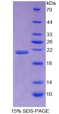 N-乙基馬來酰亞胺敏感因子(NSF)重組蛋白,Recombinant N-Ethylmaleimide Sensitive Factor (NSF)