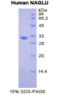 N-乙酰α-D-氨基葡萄糖苷酶(NAGLU)重组蛋白,Recombinant N-Acetyl Alpha-D-Glucosaminidase (NAGLU)