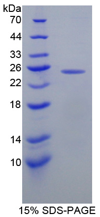 O-6-甲基鸟嘌呤DNA甲基转移酶(MGMT)重组蛋白,Recombinant O-6-Methylguanine DNA Methyltransferase (MGMT)