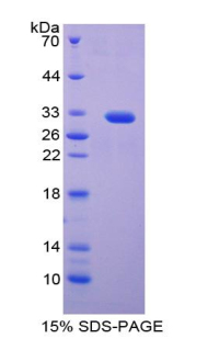 p21蛋白激活激酶1(PAK1)重组蛋白,Recombinant p21 Protein Activated Kinase 1 (PAK1)