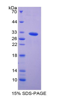 p21蛋白激活激酶2(PAK2)重组蛋白,Recombinant p21 Protein Activated Kinase 2 (PAK2)