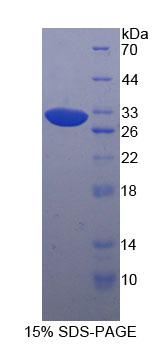 p21蛋白激活激酶4(PAK4)重組蛋白,Recombinant p21 Protein Activated Kinase 4 (PAK4)