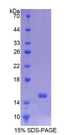 p53上調(diào)凋亡調(diào)節(jié)因子(PUMA)重組蛋白,Recombinant p53 Upregulated Modulator Of Apoptosis (PUMA)