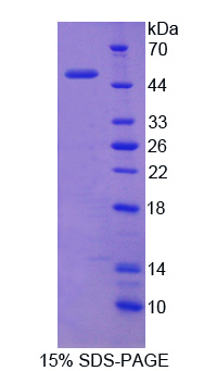 Pescadillo同源物1(PES1)重组蛋白,Recombinant Pescadillo Homolog 1 (PES1)