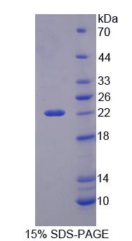 PHD指蛋白8(PHF8)重组蛋白,Recombinant PHD Finger Protein 8 (PHF8)