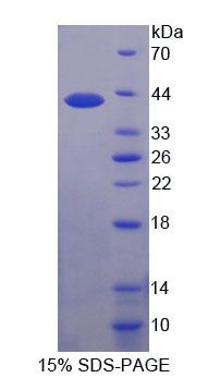 Pim-3原癌基因(PIM3)重组蛋白,Recombinant Pim-3 Oncogene (PIM3)