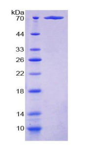 PP2A癌症抑制抑制因子(CIP2A)重组蛋白,Recombinant Cancerous Inhibitor Of PP2A (CIP2A)