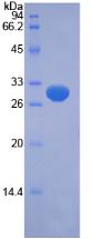 PTEN诱导假定激酶1(PINK1)重组蛋白,Recombinant PTEN Induced Putative Kinase 1 (PINK1)