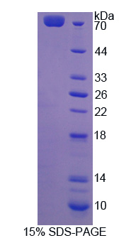 Rac-GTP酶激活蛋白1(RACGAP1)重组蛋白,Recombinant Rac-GTPase Activating Protein 1 (RACGAP1)