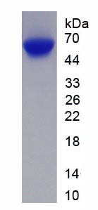 RAD23同源物B(RAD23B)重组蛋白,Recombinant RAD23 Homolog B (RAD23B)