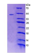 RAD51同源物(RAD51)重組蛋白,Recombinant RAD51 Homolog (RAD51)