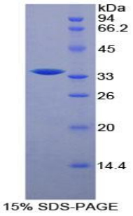 Raft交联蛋白(Raftlin)重组蛋白,Recombinant Raft Linking Protein (Raftlin)