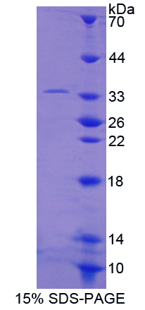 Rap鳥嘌呤核苷酸交換因子1(RAPGEF1)重組蛋白,Recombinant Rap Guanine Nucleotide Exchange Factor 1 (RAPGEF1)