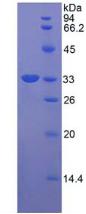 RAR相关孤儿素受体γ(RORg)重组蛋白,Recombinant RAR Related Orphan Receptor Gamma (RORg)