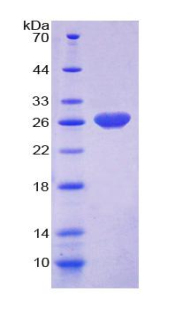 Ras GTP酶激活蛋白1(RASA1)重组蛋白,Recombinant Ras GTPase Activating Protein 1 (RASA1)