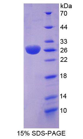 RAS癌基因家族成员RAB37(RAB37)重组蛋白,Recombinant RAB37, Member RAS Oncogene Family (RAB37)