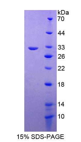 RAS癌基因家族成员RAB5A(RAB5A)重组蛋白,Recombinant RAB5A, Member RAS Oncogene Family (RAB5A)