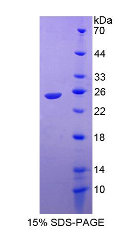 Ras相關(guān)C3肉毒菌毒素底物1(Rac1)重組蛋白,Recombinant Ras Related C3 Botulinum Toxin Substrate 1 (Rac1)