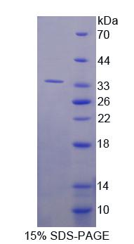 Ras抑制蛋白1(RSU1)重組蛋白,Recombinant Ras Suppressor Protein 1 (RSU1)