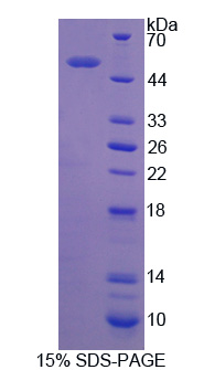 Rho GDP解離抑制因子β(ARHGDIb)重組蛋白,Recombinant Rho GDP Dissociation Inhibitor Beta (ARHGDIb)